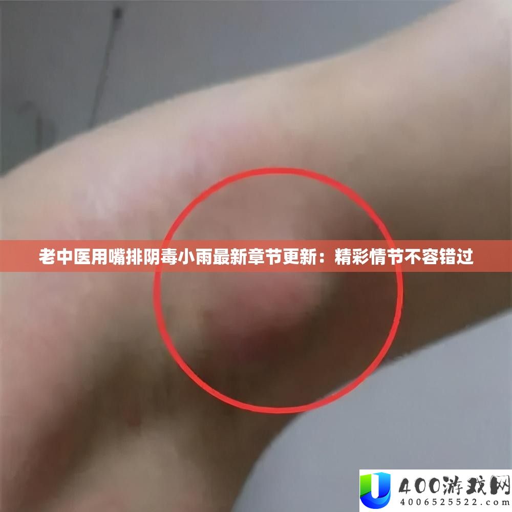 老中医用嘴排阴毒细雨最新章节更新：精彩情节不容错过