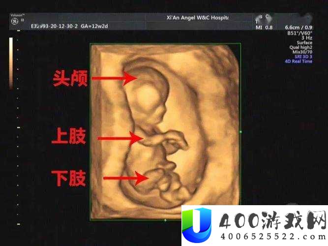 B 超医生为何会问四维哪里做的？这背后有何深意？一起来探究